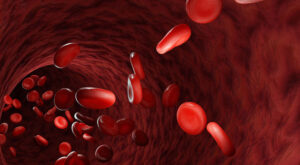 Investigating-anemia-disease-and-its-treatment-with-emphasis-on-the-use-of-medicinal-plants