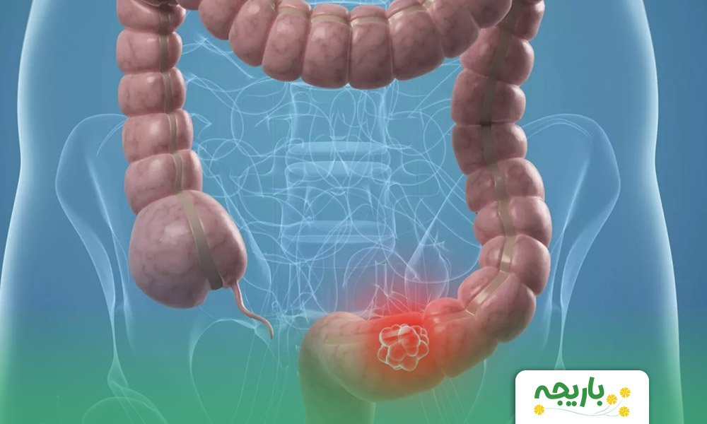 Constipation-at-home3